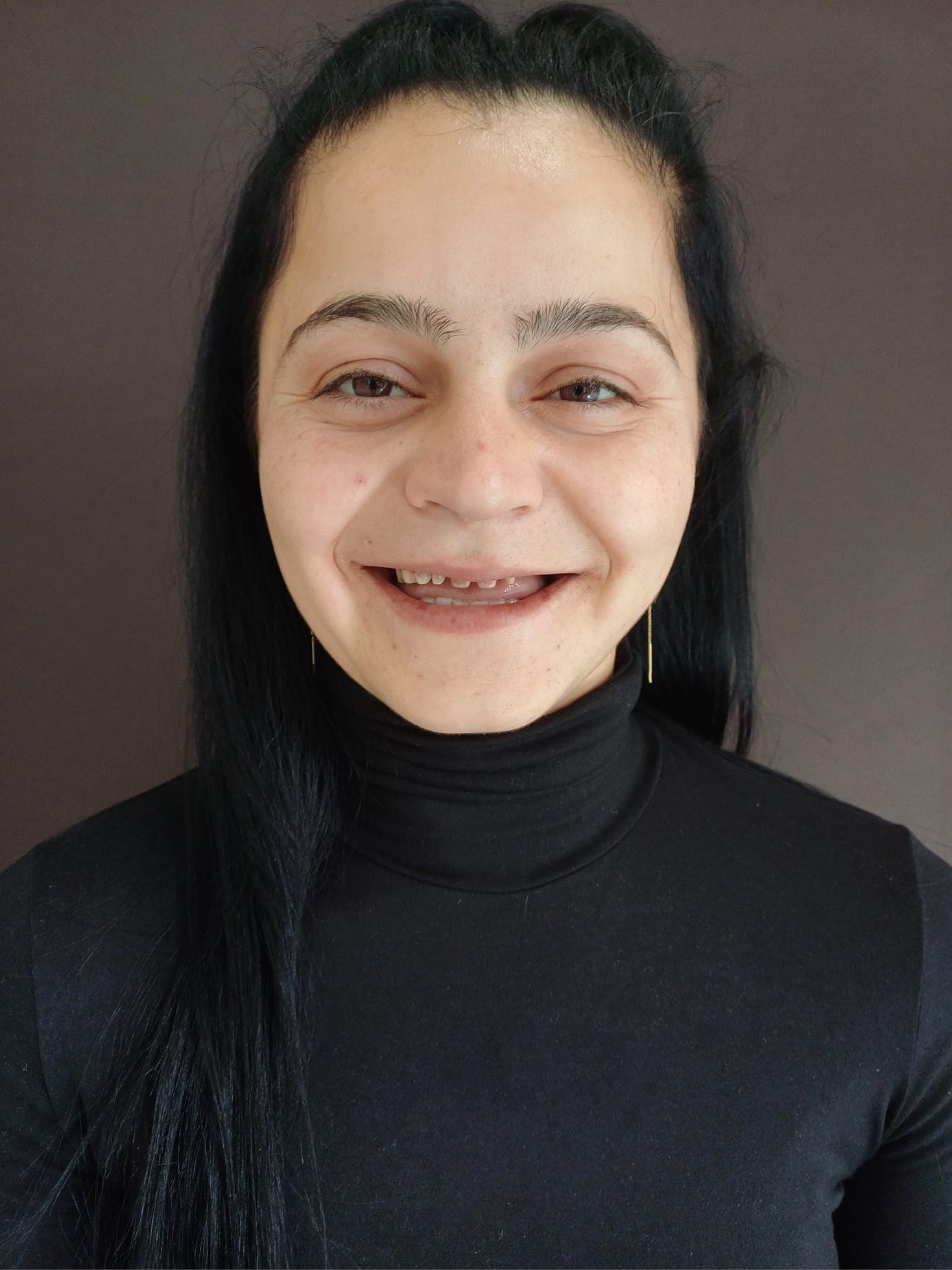 Înainte